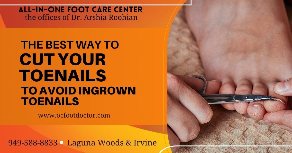 https://www.ocfootdoctor.com/Upload/promotionImages/133005/the-best-way-to-cut-your-toenails-to-avoid-ingrown-toenails.jpg